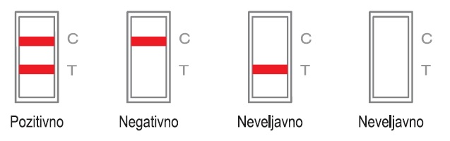 Interpretacija rezultatov testa za Covid-19